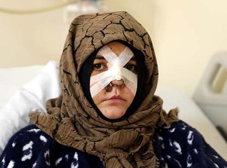 Nazlı Yavuz'un Dramı: Kaldırım Taşıyla Saldırıya Uğrayan Kadının Çağrısı